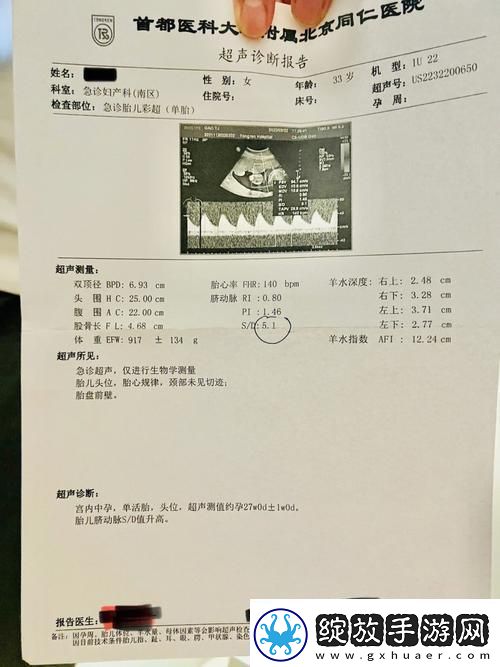 “OVO食肉族报告4”
