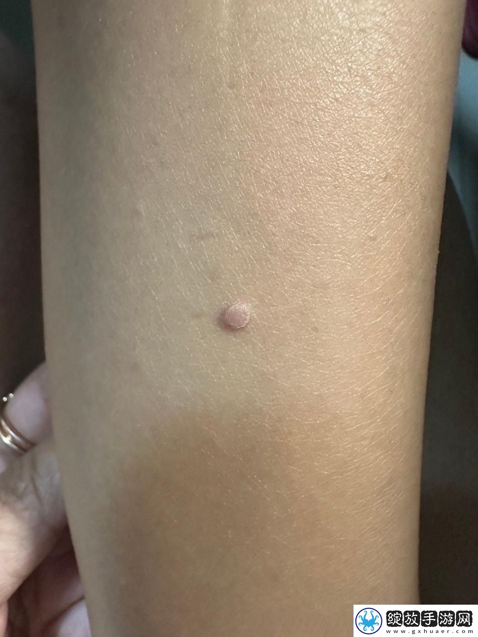 疙瘩里头硬邦邦