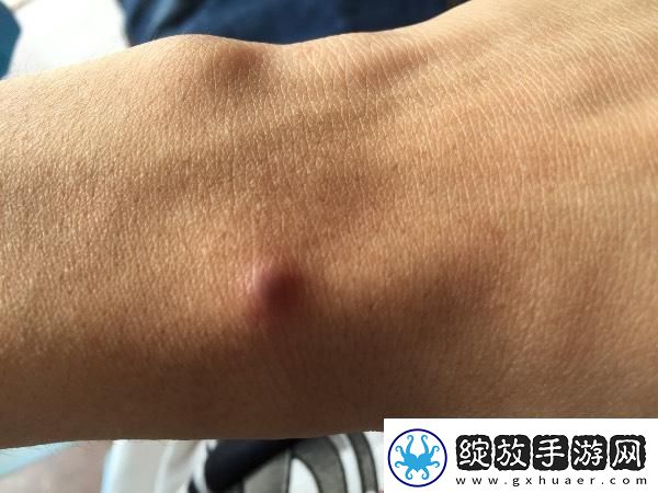 皮下珠子科技界的独树一帜