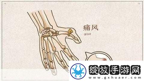 宝宝怎么才三根手指就痛1.宝宝三根手指疼痛的原因与解决办法