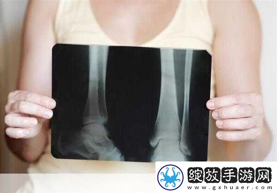 好想C1V1骨科患者的真实反馈