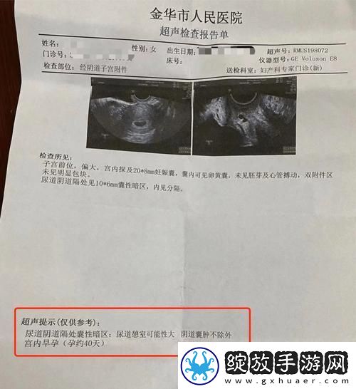 医生边做B超边与患者沟通