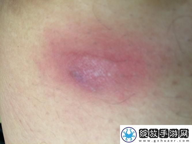 科技江湖突现「身体疙瘩侠」
