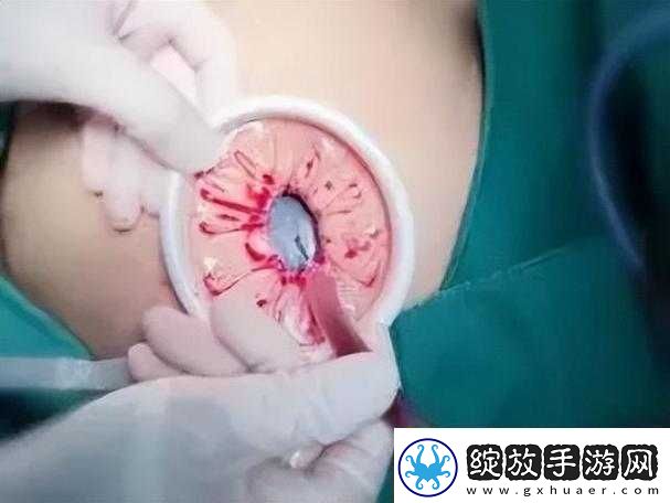 腹部灌满隆起**令人震撼的奇特景象