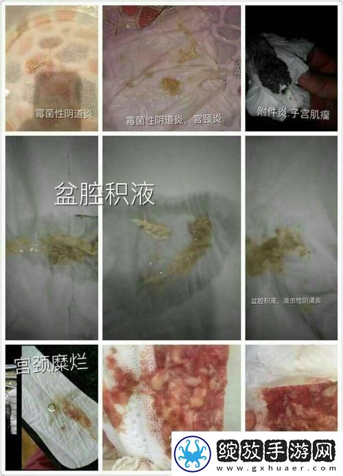 “月月我这是帮你排阴毒”潮流背后