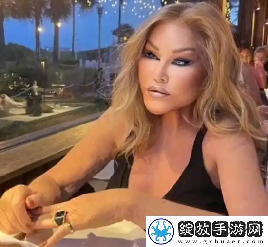 整容成“猫女”的瑞士名媛因心脏衰竭去世