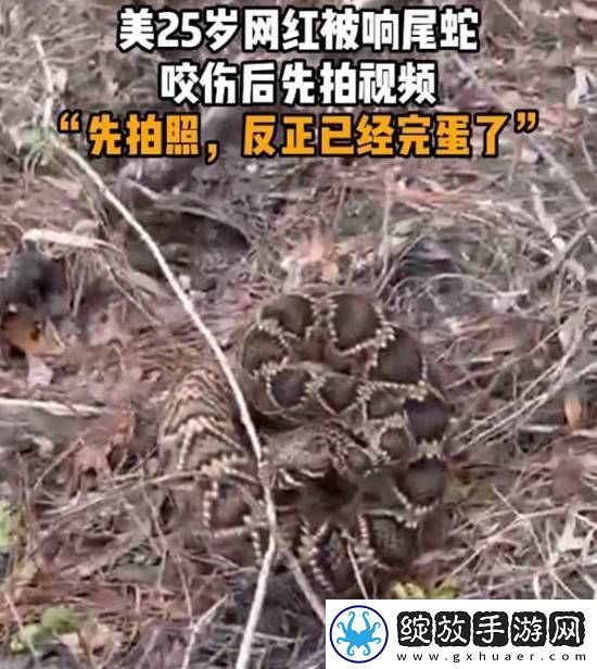 美国25岁红被响尾蛇咬伤后先拍视频