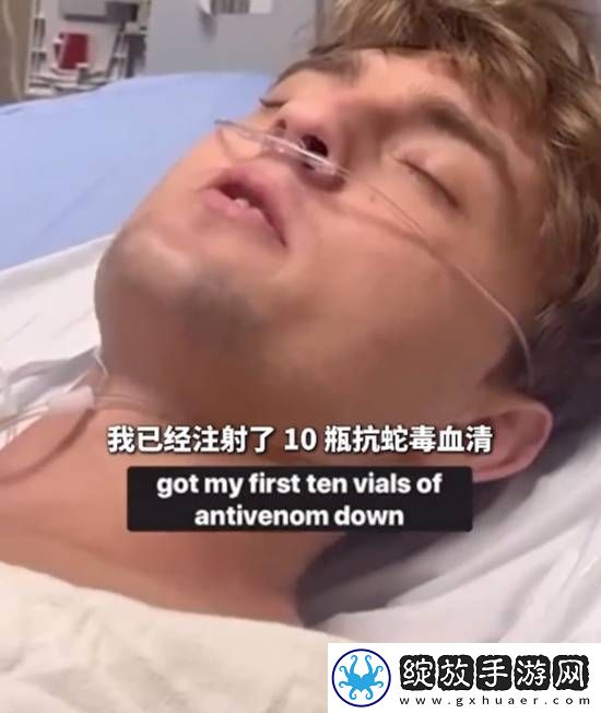 美国25岁红被响尾蛇咬伤后先拍视频