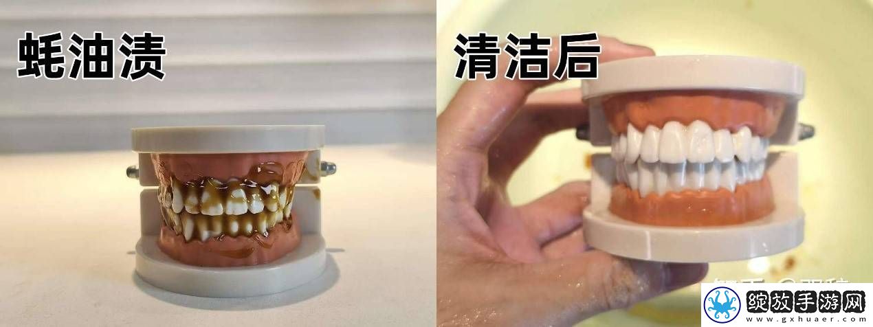 2025年口腔护理新宠！知乎大咖力荐欧可林AirPump