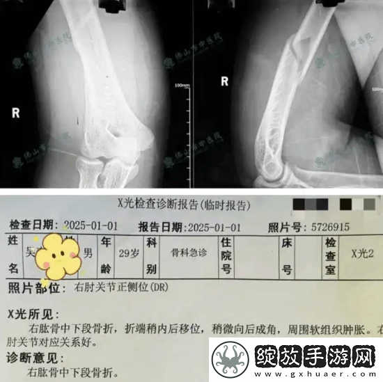俩小伙挑战与机器人“掰手腕”