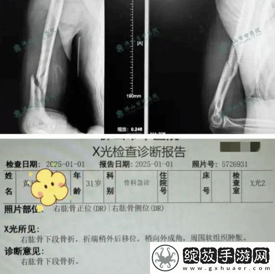 俩小伙挑战与机器人“掰手腕”