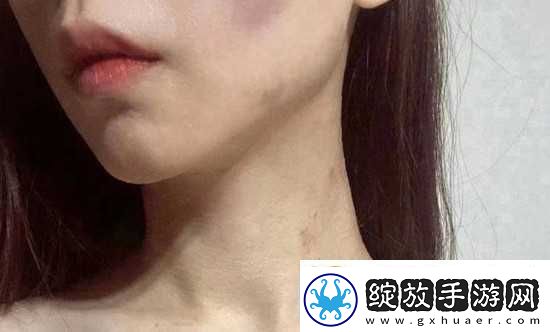 红雅典娜LIYA死了吗