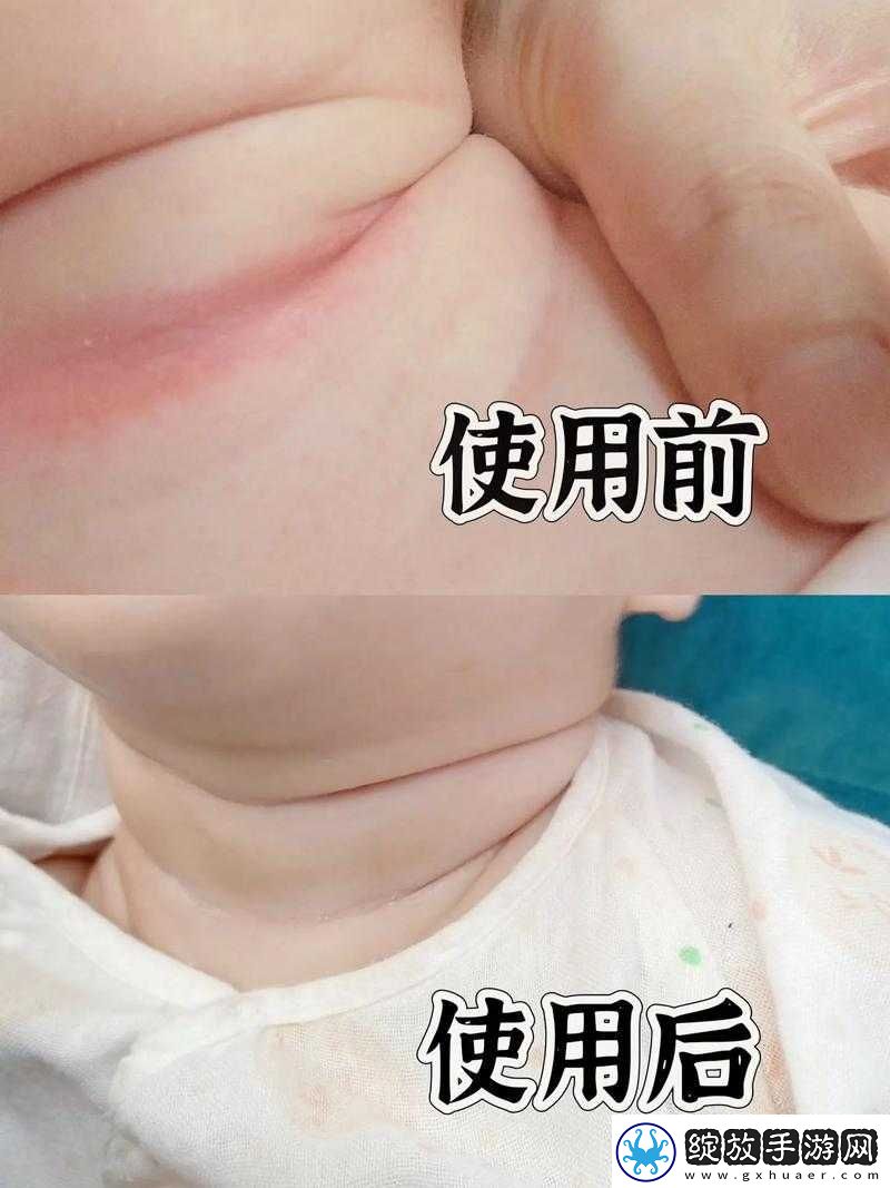 宝宝下面都湿透了还嘴硬疼咋回事
