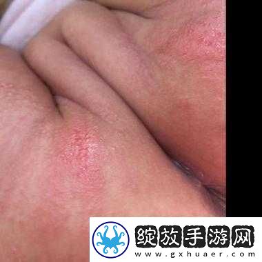 宝宝湿透还嘴硬说疼究竟是怎么回事呢