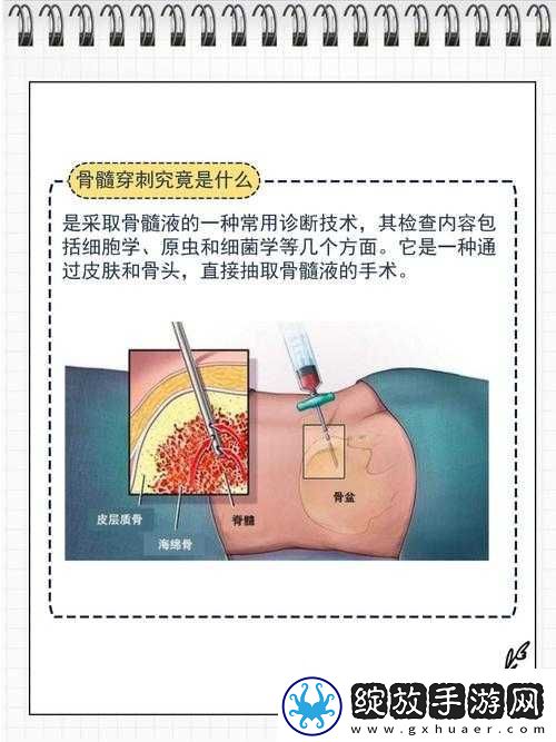 用注射器打水放**里相关站探秘