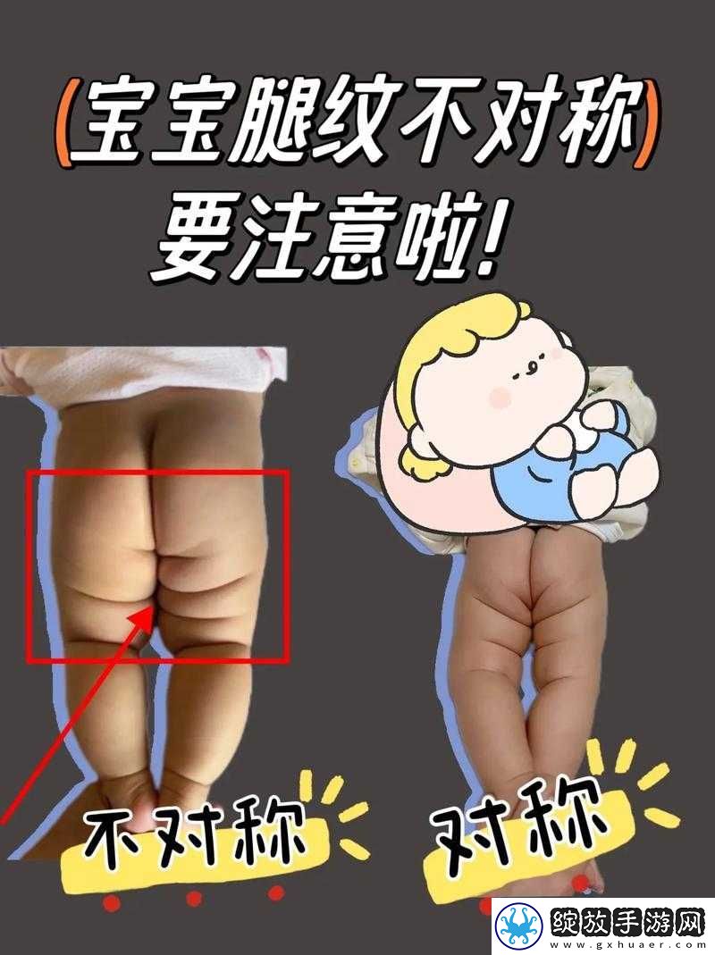 宝贝腿张大点就不疼